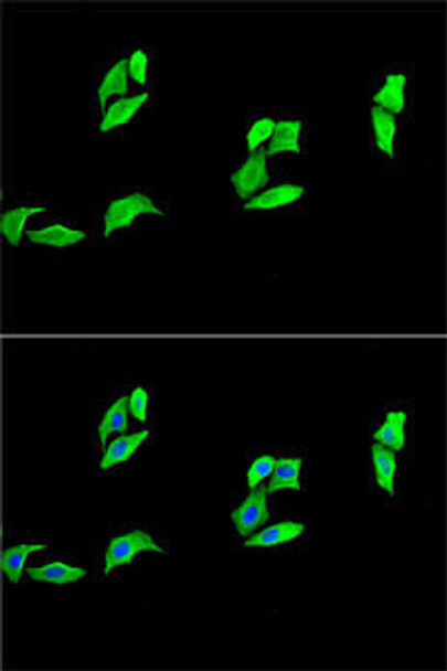 Anti-MB Antibody (CAB13326)