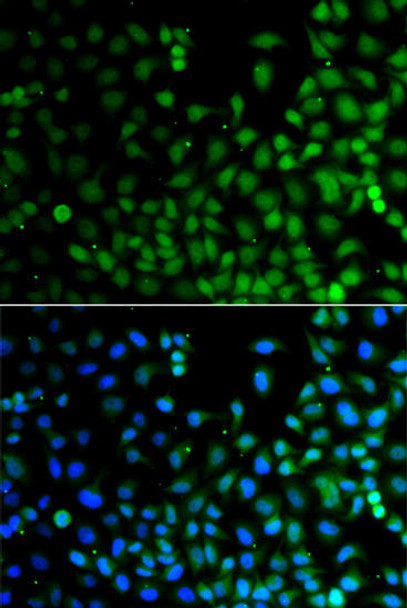 Anti-LHX6 Antibody (CAB13413)