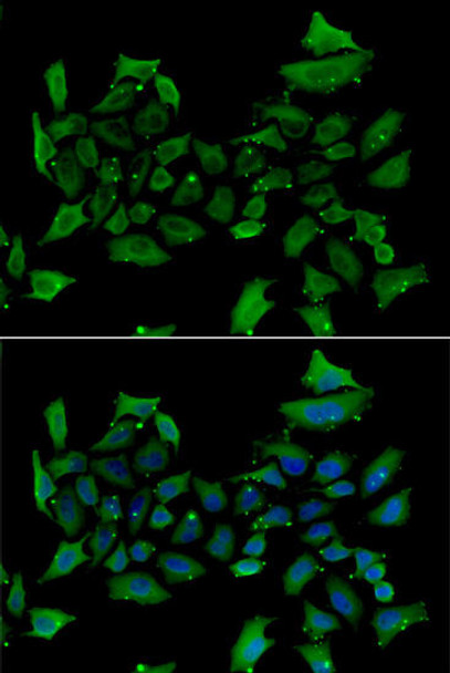 Anti-ALAS1 Antibody (CAB13462)