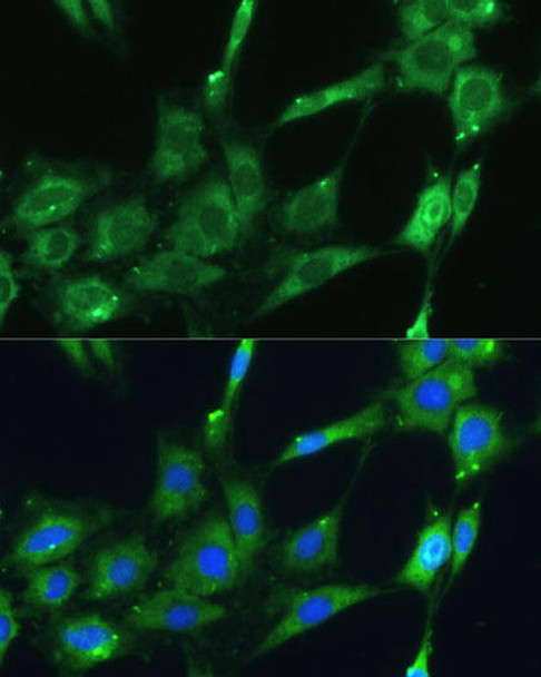 Anti-SPARC Antibody (CAB14494)