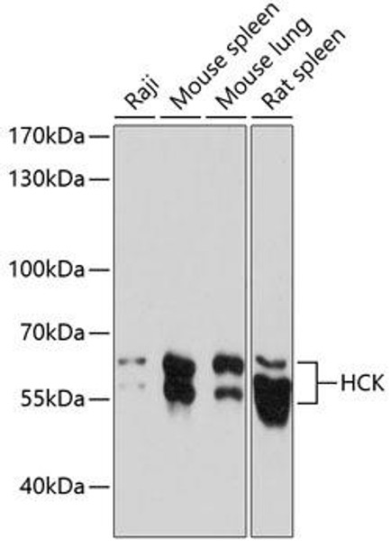 Anti-HCK Antibody (CAB14537)