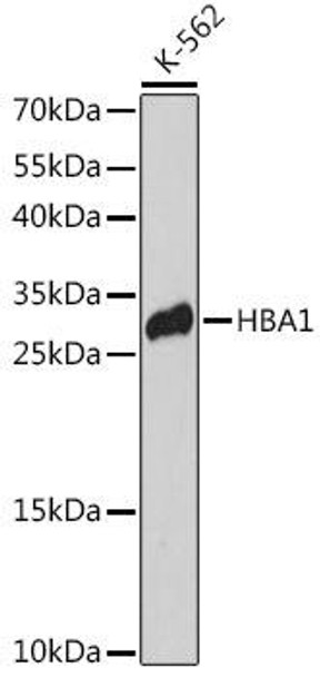 Anti-HBA1 Antibody (CAB14551)