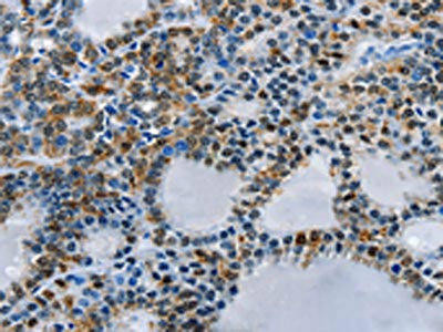 BCOR Antibody (PACO13954)