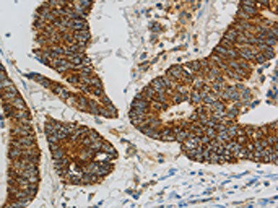 CCNF Antibody (PACO14313)