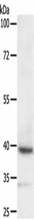 DTX3 Antibody (PACO14337)