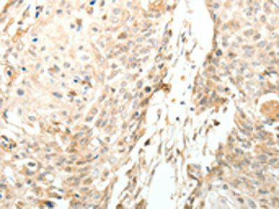 LRP12 Antibody (PACO14655)