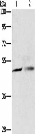 PGBD4 Antibody (PACO15205)