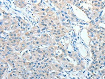 AKAP9 Antibody (PACO15360)