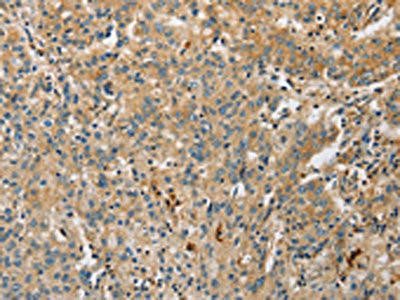 ARL8A Antibody (PACO15526)