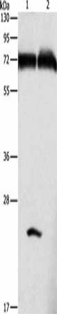 GDPD5 Antibody (PACO15549)