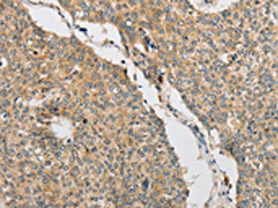 ART3 Antibody (PACO15565)