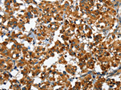 SLAMF8 Antibody (PACO15872)