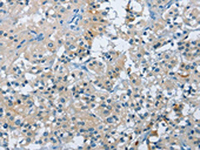 BTN2A2 Antibody (PACO15892)