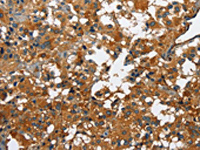 CATSPER3 Antibody (PACO15940)
