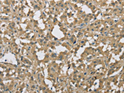 DACH2 Antibody (PACO16137)