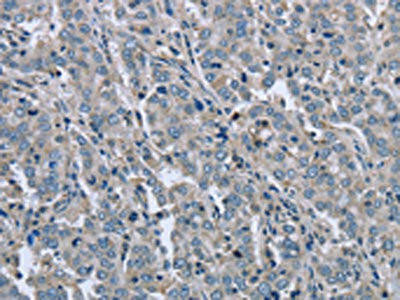 FAR2 Antibody (PACO16315)