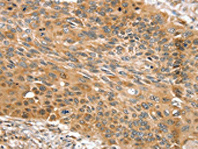 SNX11 Antibody (PACO17136)