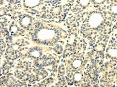 TBC1D22A Antibody (PACO17210)