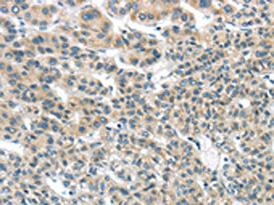 THSD1 Antibody (PACO17239)