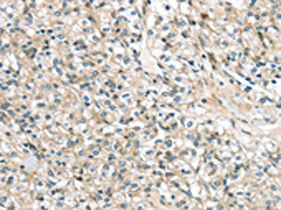 TMPRSS11B Antibody (PACO17285)