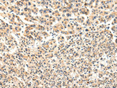 VPS33A Antibody (PACO17440)