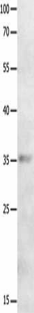 MAGEA2 Antibody (PACO18184)