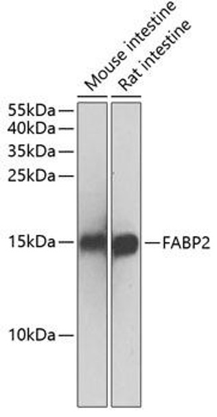 Anti-FABP2 Antibody (CAB1621)