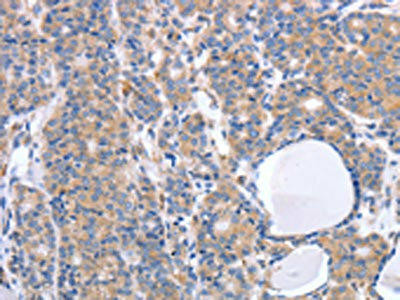 GFRA4 Antibody (PACO18432)
