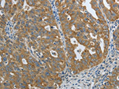 PTPRM Antibody (PACO18857)