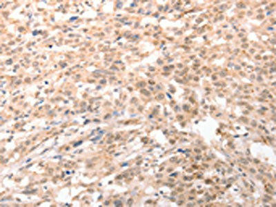 ACIN1 Antibody (PACO19042)