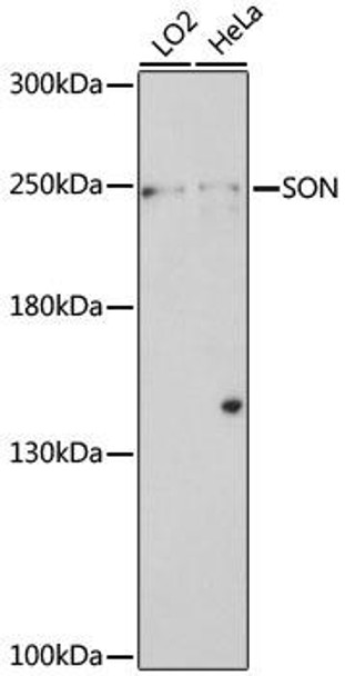 Anti-SON Antibody (CAB16323)