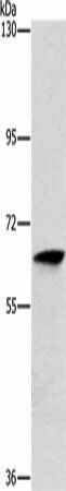 ALG6 Antibody (PACO19092)