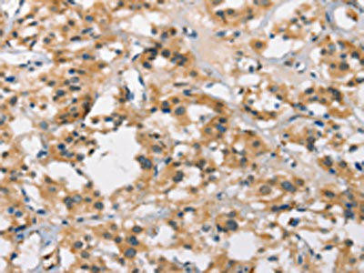 MARC1 Antibody (PACO19230)