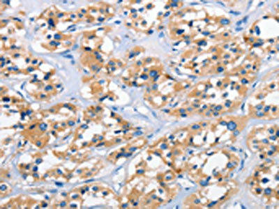 APOL6 Antibody (PACO19318)