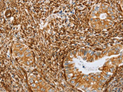BRS3 Antibody (PACO19363)