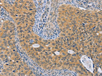 BRS3 Antibody (PACO19364)