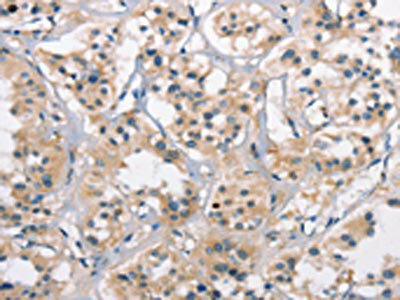 CTAG1A/CTAG1A Antibody (PACO19523)