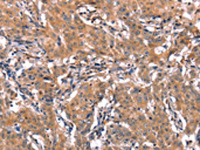 ERAS Antibody (PACO19614)