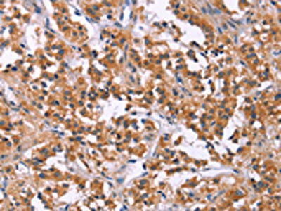 MSMO1 Antibody (PACO19616)