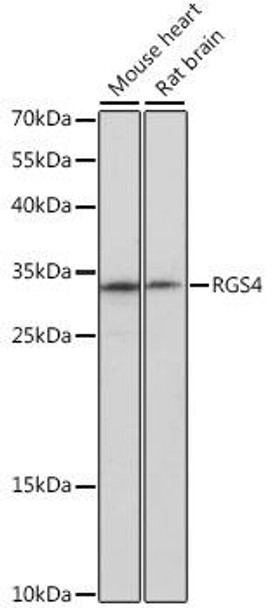 Anti-RGS4 Antibody (CAB16423)