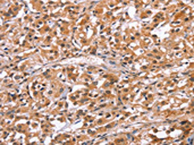 HRK Antibody (PACO19792)