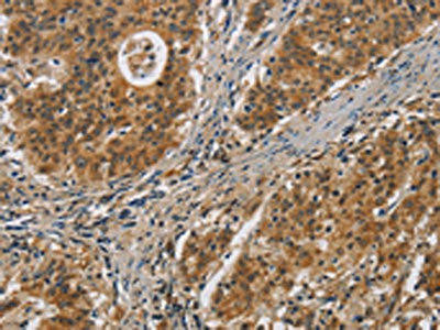 IL17D Antibody (PACO19822)