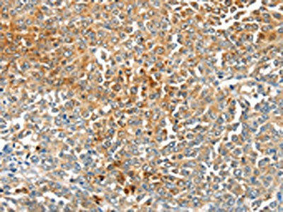 MAGEB2 Antibody (PACO19969)