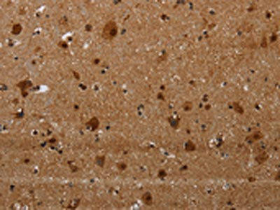 MAGEE1 Antibody (PACO19976)