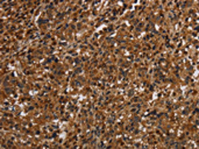 MAGEC2 Antibody (PACO19978)