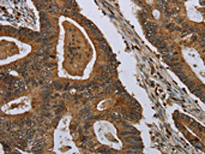 MIG7 Antibody (PACO20020)