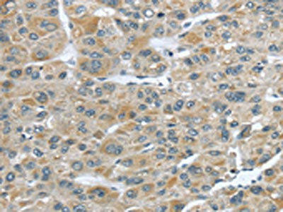 CFAP45 Antibody (PACO20080)