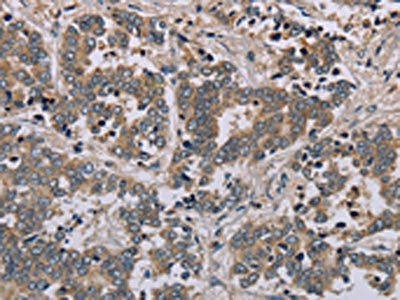 AATK Antibody (PACO20089)