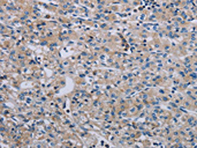 PAGE4 Antibody (PACO20168)