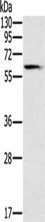 SLC45A3 Antibody (PACO20183)